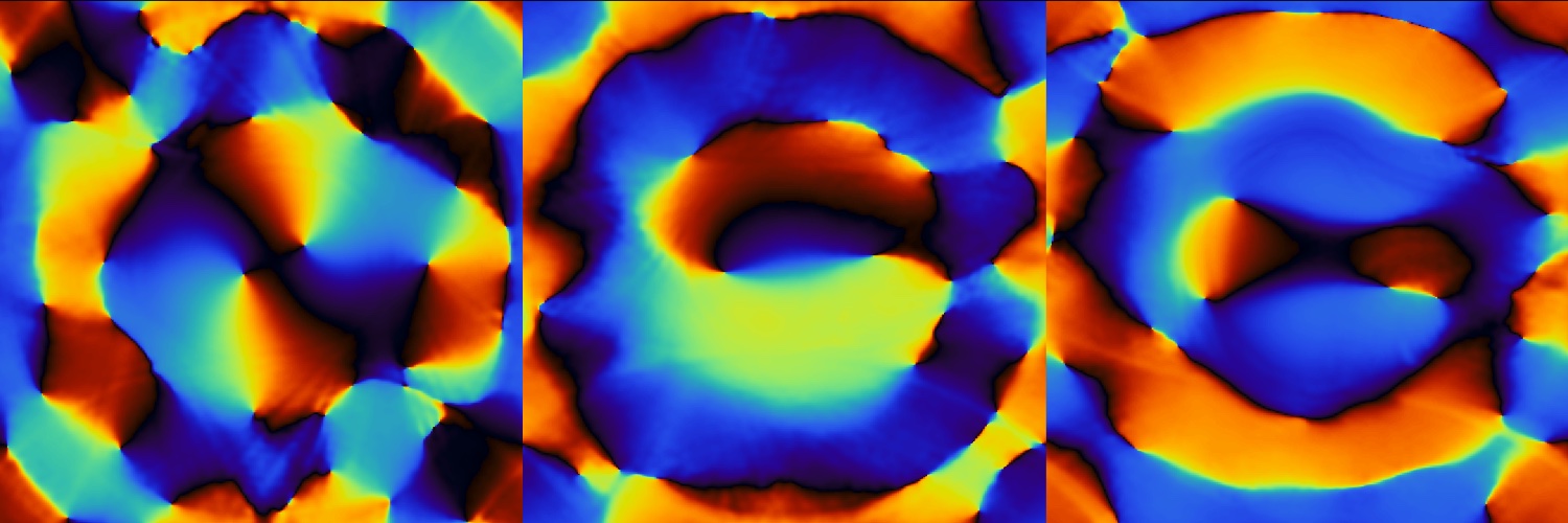 A virtual channel sensitivity map (phase)